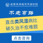 成都看类风湿医院：类风湿疼痛怎样缓解?